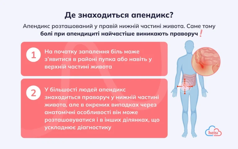 Коли знімати плівку з розсади: точні ознаки та покрокова адаптація
